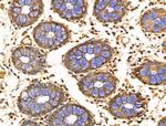 KCNN2 Antibody in Immunohistochemistry (Paraffin) (IHC (P))