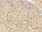 KCNN2 Antibody in Immunohistochemistry (Paraffin) (IHC (P))