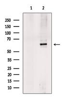 KCNN2 Antibody in Western Blot (WB)