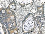 KCNN3 Antibody in Immunohistochemistry (Paraffin) (IHC (P))