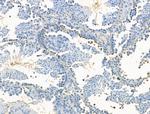 JMJD2B Antibody in Immunohistochemistry (Paraffin) (IHC (P))