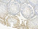 JMJD2B Antibody in Immunohistochemistry (Paraffin) (IHC (P))