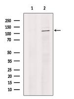 JMJD2B Antibody in Western Blot (WB)