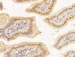 JARID1C Antibody in Immunohistochemistry (Paraffin) (IHC (P))