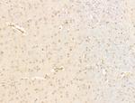 JARID1C Antibody in Immunohistochemistry (Paraffin) (IHC (P))