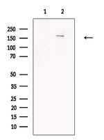 KDM6A Antibody in Western Blot (WB)