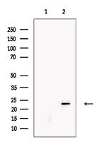 KGF Antibody in Western Blot (WB)