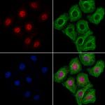 KIF17 Antibody in Immunocytochemistry (ICC/IF)