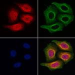 KIF4A Antibody in Immunocytochemistry (ICC/IF)