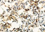 KIF4A Antibody in Immunohistochemistry (Paraffin) (IHC (P))