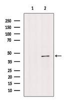 Herpes Simplex Virus Type 1 (strain CL101) Antibody in Western Blot (WB)