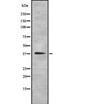 Varicella zoster Virus (strain Dumas) Antibody in Western Blot (WB)