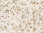 KLF2 Antibody in Immunohistochemistry (Paraffin) (IHC (P))