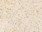 KLF2 Antibody in Immunohistochemistry (Paraffin) (IHC (P))