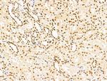 KLF2 Antibody in Immunohistochemistry (Paraffin) (IHC (P))