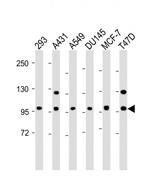 E-cadherin Antibody in Western Blot (WB)