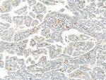 SETDB1 Antibody in Immunohistochemistry (Paraffin) (IHC (P))