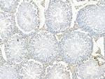 SETDB1 Antibody in Immunohistochemistry (Paraffin) (IHC (P))