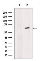 SUV420H2 Antibody in Western Blot (WB)