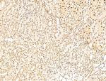 L3MBTL1 Antibody in Immunohistochemistry (Paraffin) (IHC (P))