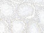 L3MBTL1 Antibody in Immunohistochemistry (Paraffin) (IHC (P))