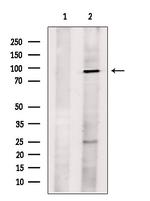 L3MBTL1 Antibody in Western Blot (WB)