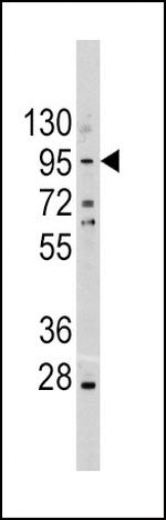 E-cadherin Antibody in Western Blot (WB)