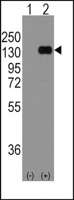 E-cadherin Antibody in Western Blot (WB)