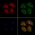 LAMTOR1 Antibody in Immunocytochemistry (ICC/IF)