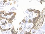 LAMTOR1 Antibody in Immunohistochemistry (Paraffin) (IHC (P))