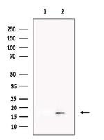 LAMTOR1 Antibody in Western Blot (WB)