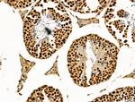 LAP2 Antibody in Immunohistochemistry (Paraffin) (IHC (P))