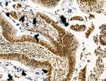 LAP2 Antibody in Immunohistochemistry (Paraffin) (IHC (P))