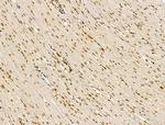 LAP2 Antibody in Immunohistochemistry (Paraffin) (IHC (P))