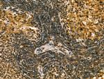 LAP2 Antibody in Immunohistochemistry (Paraffin) (IHC (P))