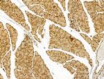 LAP2 Antibody in Immunohistochemistry (Paraffin) (IHC (P))