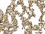 LAP2 Antibody in Immunohistochemistry (Paraffin) (IHC (P))