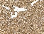 LAP2 Antibody in Immunohistochemistry (Paraffin) (IHC (P))