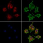 Lass2 Antibody in Immunocytochemistry (ICC/IF)