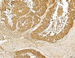 Lass2 Antibody in Immunohistochemistry (Paraffin) (IHC (P))