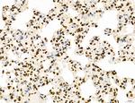 Lass2 Antibody in Immunohistochemistry (Paraffin) (IHC (P))