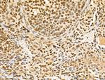 Lass2 Antibody in Immunohistochemistry (Paraffin) (IHC (P))