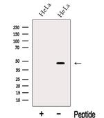 Lass2 Antibody in Western Blot (WB)