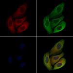 LAT Antibody in Immunocytochemistry (ICC/IF)