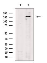 LATS1/LATS2 Antibody in Western Blot (WB)