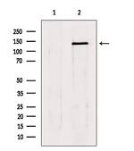 LATS1/LATS2 Antibody in Western Blot (WB)