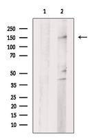 LATS2 Antibody in Western Blot (WB)