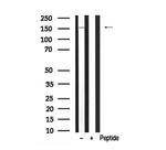 LATS2 Antibody in Western Blot (WB)