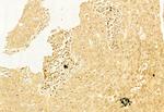 LC3A/LC3B Antibody in Immunohistochemistry (Paraffin) (IHC (P))