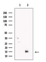 LC3A/LC3B Antibody in Western Blot (WB)